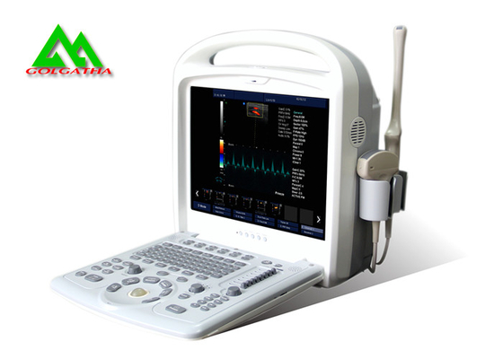 Chine Conception portative d'ordinateur portable de Doppler de couleur d'équipement médical d'ultrason d'hôpital fournisseur